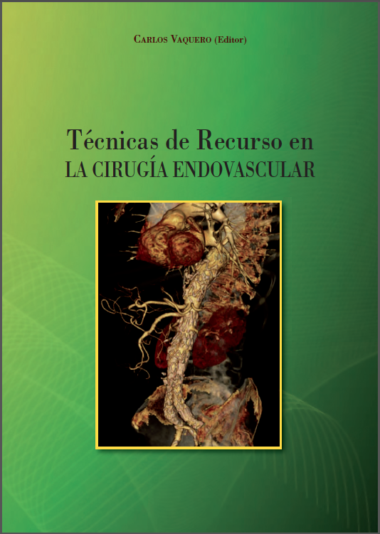 Dr. Borja Merino | 'Técnicas de recurso en la cirugía endovascular